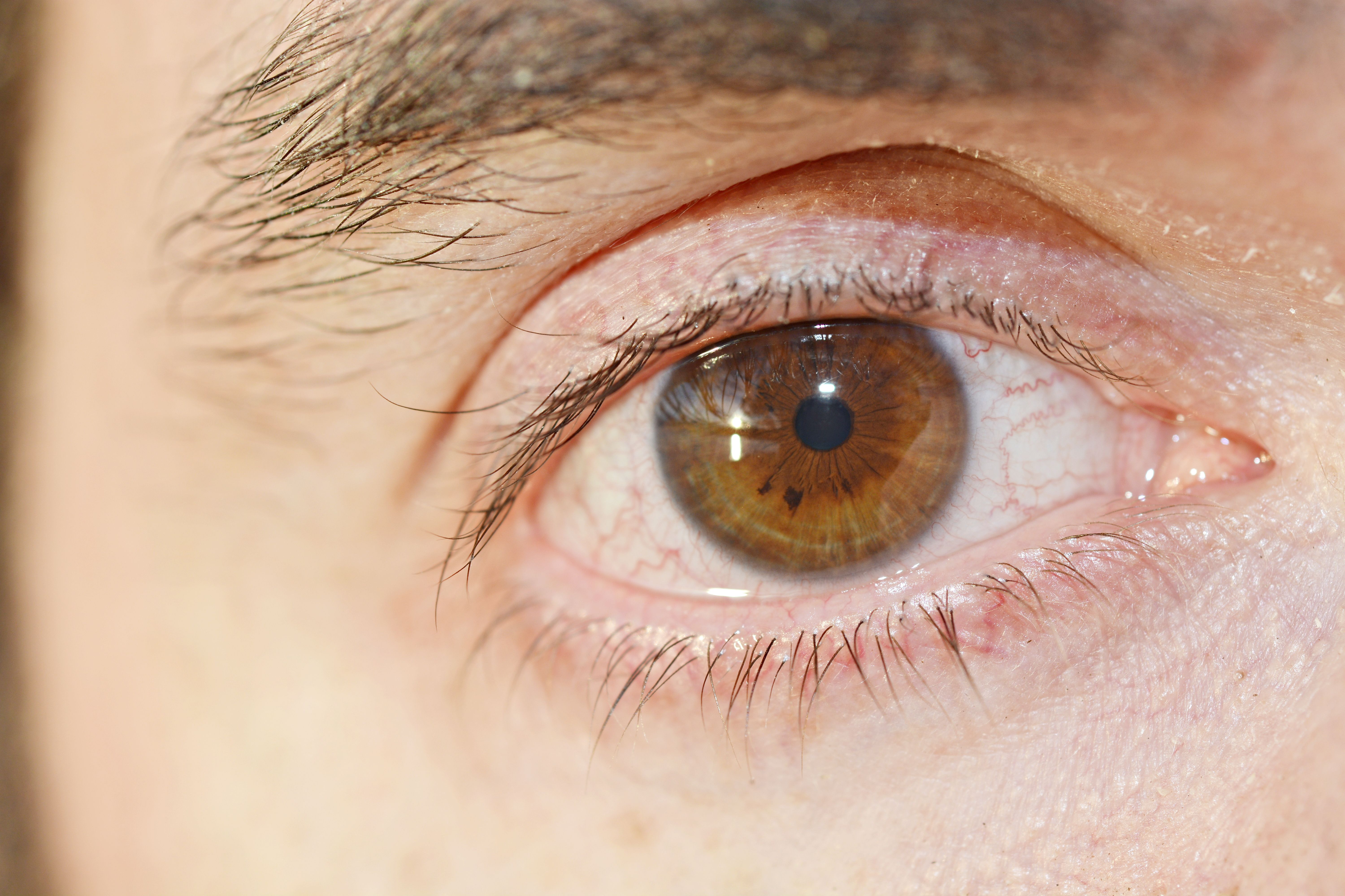 Ojo Seco